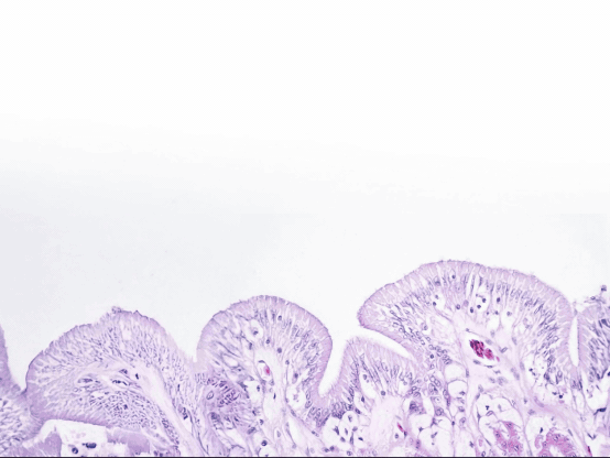 Pyour to launch 2026: revolutionary gut-health product with 2FX